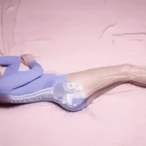 HipLift - Orthopädisches Kniekissen vermeidet Rücken- & Ischiasbeschwerden